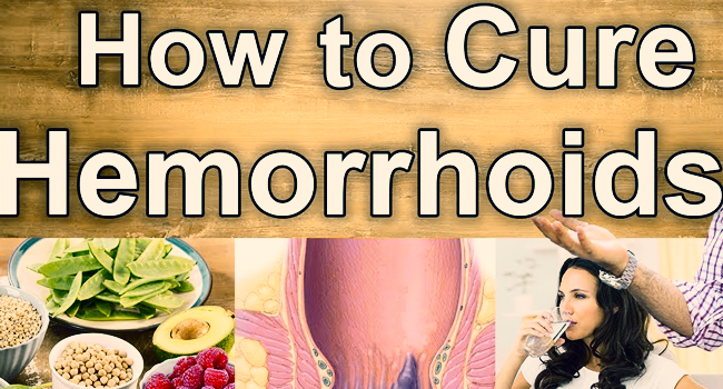 An Introduction to Natural Hemorrhoids Treatments
